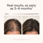 Before and after 6 months