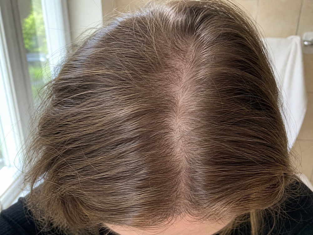 Months 2–3